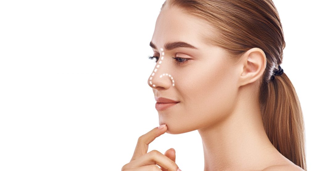 model with dotted lines outlining her nose for rhinoplasty