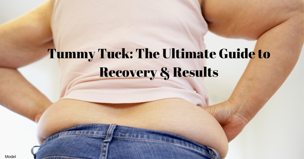 The Ultimate Guide to a Tummy Tuck