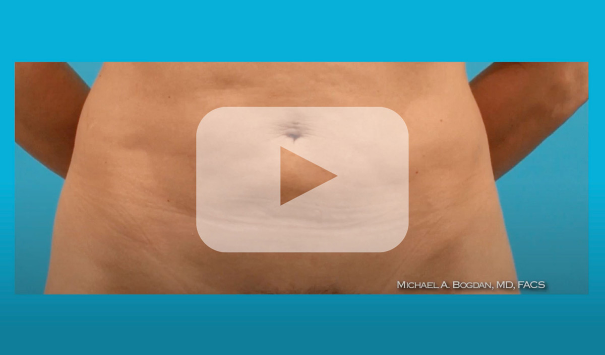 Screenshot of 2301 Plastic Surgery "Scar Maturation" video.